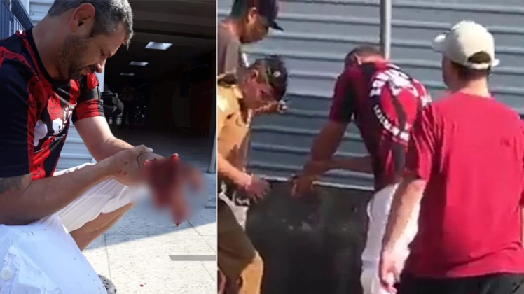 Un hincha del Atlético Paranaense perdió la mano cuando le explotó una bomba